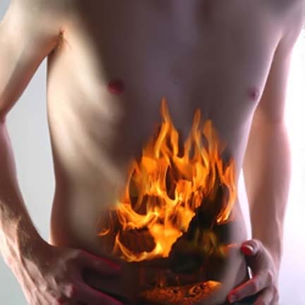 What is hyper acidity or heartburn or dyspepsia